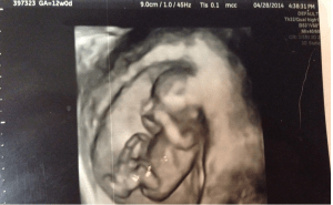 Source: http://www.lifenews.com/2015/04/28/thousands-of-babies-born-every-year-with-brain-damage-because-their-moms-did-this-while-pregnant/